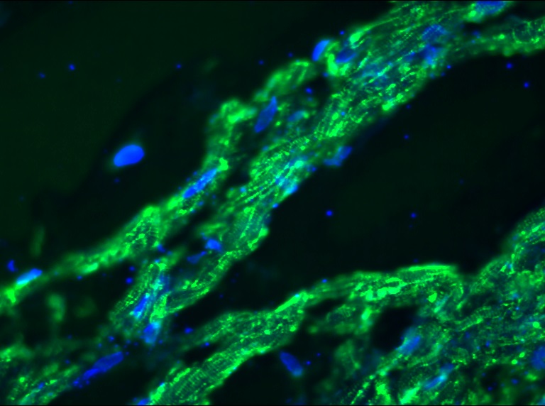 Figure 1. Indirect immunofluorescence staining of human heart with MUB0308P (SR-2) showing positive staining of mitochondria.